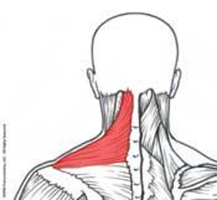 How Do You Relieve Upper Trapezius Pain Empower Physio And Wellness